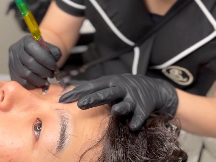 眉アートメイクの施術中